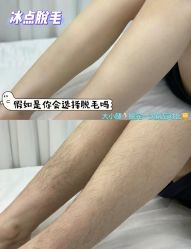 -薇兰专业脱毛连锁机构