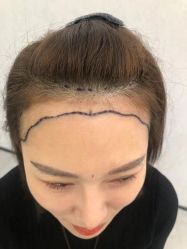 -熙朵美学植发·连锁品牌