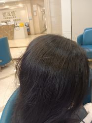 -碧莲盛·不剃发植发