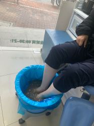 -德哥灰指甲脚气甲沟炎跖疣护理