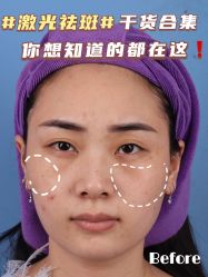 -广州美莱医疗美容医院