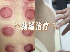 -华集正·专业正骨推拿(集美店)