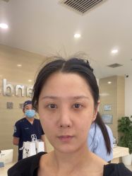 -澳尔颜选医疗美容