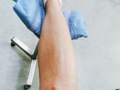 -广州市红十字会医院(总院)