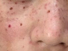 -重庆医科大学附属第一医院(本部)