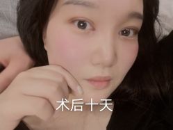 -西安壹加壹医疗美容·西北抗衰旗舰店
