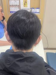 -大麦微针植发丨全国连锁