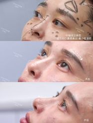-Yestar宁波艺星整形医院