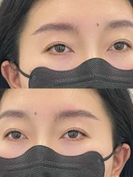 点击看大图 -杨益美学·野生眉半永久纹眉发际线