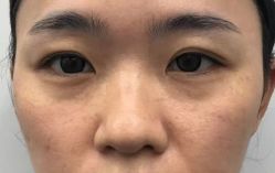 -天津健丽·去眼袋医疗美容机构