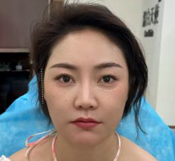 点击看大图 体验前-Yestar艺星医疗美容医院