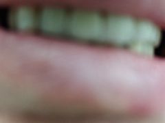 -极光口腔·矫正种植修复(锦江院区)