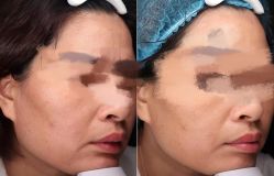-苑苑vbeauty科技美容SPA