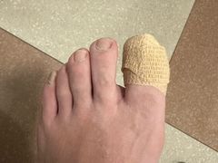 -世龙世家灰指甲鸡眼脚气甲沟炎跖疣护理(通州店)
