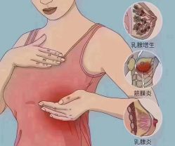 -香薇妮丝女子减肥院