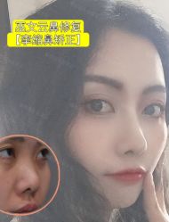 -北京米扬丽格医疗美容·联合丽格鼻整形中心