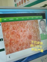 -成都军建医院·疤痕诊疗中心