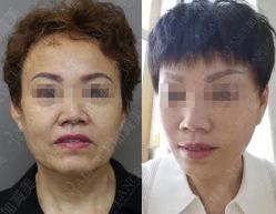 -加减美医美连锁品牌