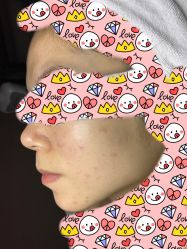 -皇族养心堂·净痘·修敏·御颜