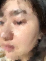 点击看大图 体验前-瑞鑫创美·高定轻医美