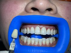 -极光口腔·矫正种植修复(锦江院区)