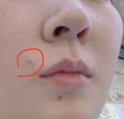 -厦门美莱整形美容医院