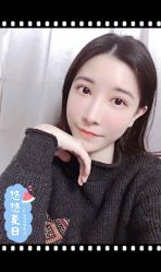 点击看大图 体验后-大麦微针植发全国连锁