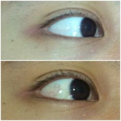 -晶奕空间专业脱毛连锁机构
