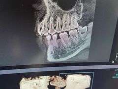 -咿呀口腔(光谷分院)