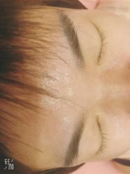 点击看大图 -郡艺医疗美容·微整·眼鼻吸脂