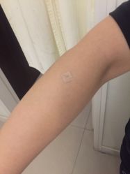 -肥三针腧穴瘦身馆