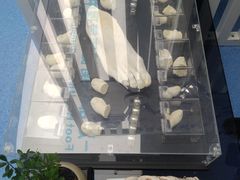 -Andrew指甲专科灰指甲·甲沟炎矫正·3D步态矫形鞋垫定制(上海法华镇路旗舰店)