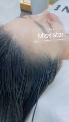 -MISS STAR·半永久纹眉·发际线·美瞳线