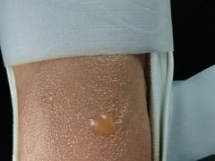 -大韩庄韩氏祖传正骨