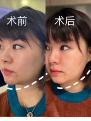 -广州美莱医疗美容医院