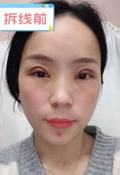-素美医疗美容·西南眼鼻整形·修复基地