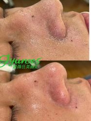 体验前-姬颜氏美丽汇皮肤管理