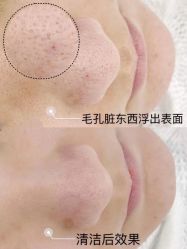 -美肤盾祛痘·问题肌头疗管理中心