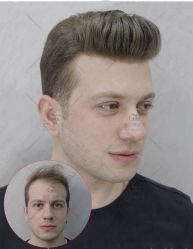 -发饰美男士增发补发假发定制店