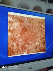 -痘博士烟台·全国连锁祛痘机构