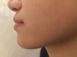 -长沙雅美医疗美容医院