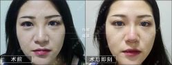 -北京丽星翼美医疗美容