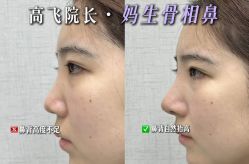 -深圳艺星医疗美容医院