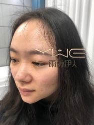 -元熙兰积皮肤管理