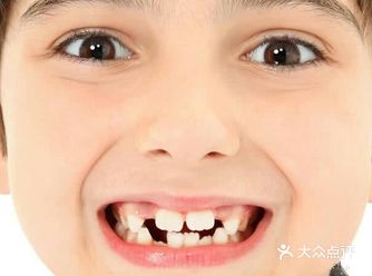宝宝牙缝有点大，是咋回事？