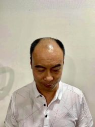 -发饰美男士增发补发假发定制店