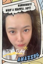 -大麦微针植发全国连锁