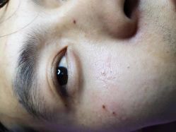 -美人痣全国连锁