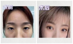 -素美医疗美容·西南眼鼻整形·修复基地