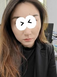 体验后-亿美医疗美容·半岛大超炮官方授权店